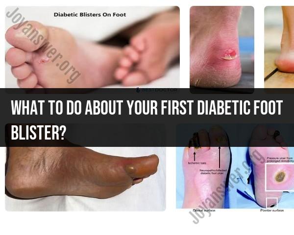 Dealing with Your First Diabetic Foot Blister: Tips and Guidelines