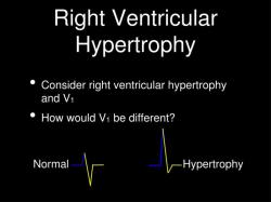 Deciphering Right Ventricular Hypertrophy: Understanding the Medical Terminology