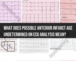 Decoding "Possible Anterior Infarct Age Undetermined" on ECG