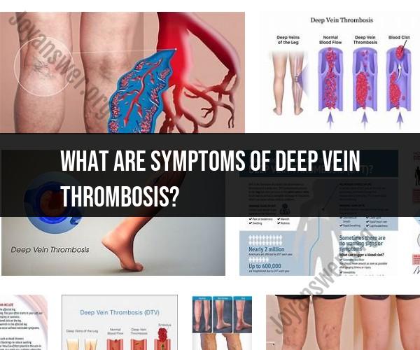 Deep Vein Thrombosis (DVT) Symptoms: Recognizing the Warning Signs