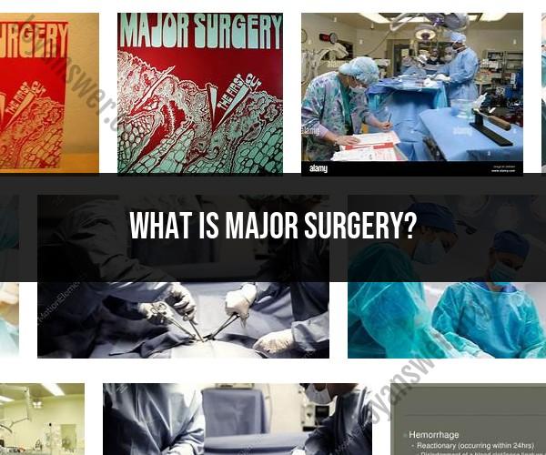 Demystifying Major Surgery: What You Need to Know