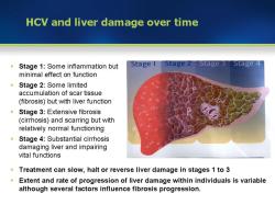 Detecting Liver Issues: Common Symptoms of Liver Disease