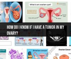 Detecting Ovarian Tumors: Signs, Symptoms, and Diagnosis