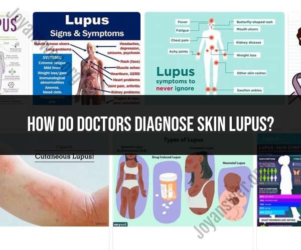 Diagnosing Skin Lupus: Insights from Medical Experts