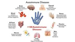 Diagnostic Testing for Autoimmune Diseases: Medical Procedures Explained