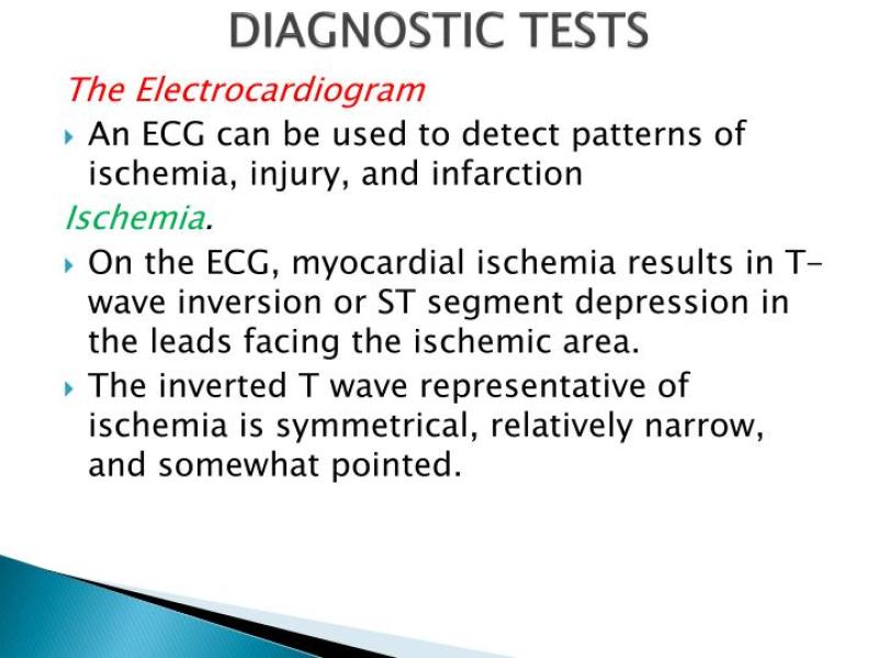 Diagnostic Tests for Myocardial Infarction: Assessment Procedures