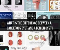 Distinguishing Between Cancerous and Benign Cysts
