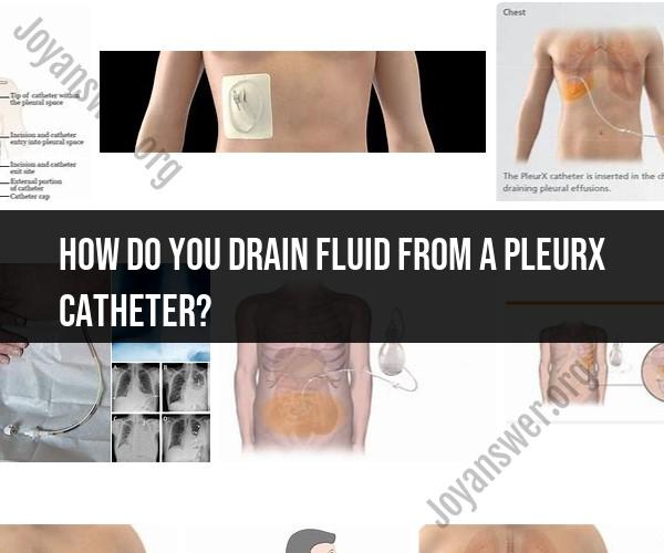 Draining Fluid from a PleurX Catheter: Step-by-Step Instructions