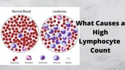 Elevated Lymphs Absolute: Exploring the Causes