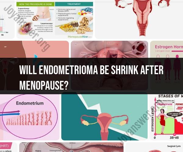 Endometrioma: Understanding Signs and Symptoms