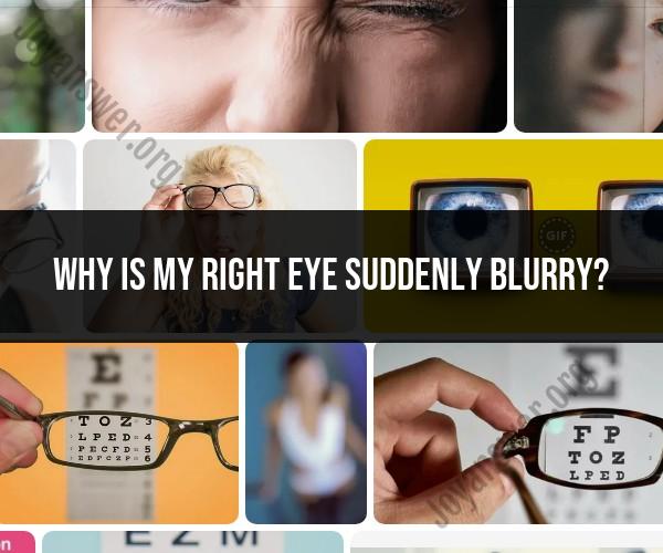 Exploring Sudden Blurriness in the Right Eye: Possible Causes and Concerns