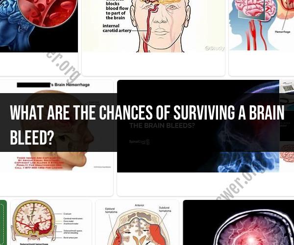 Exploring Survival Rates After a Brain Bleed