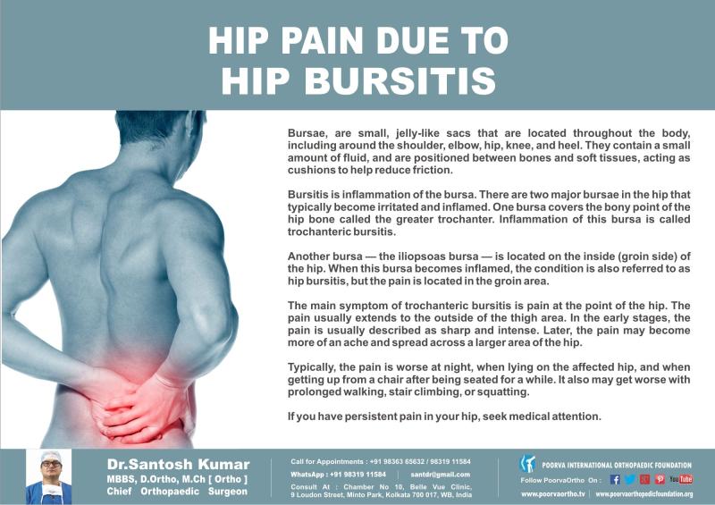 Exploring the Causes of Right Groin Pain Radiating to the Back