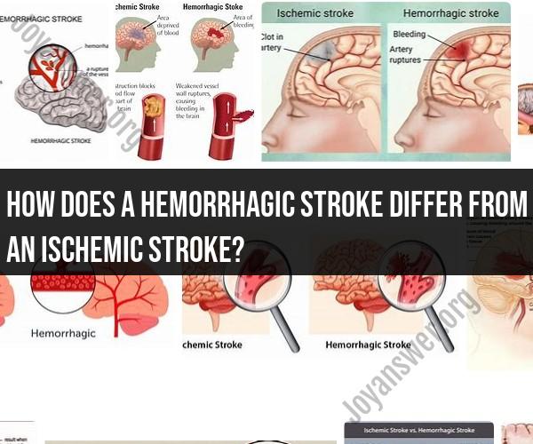 Hemorrhagic Stroke vs. Ischemic Stroke: Key Differences