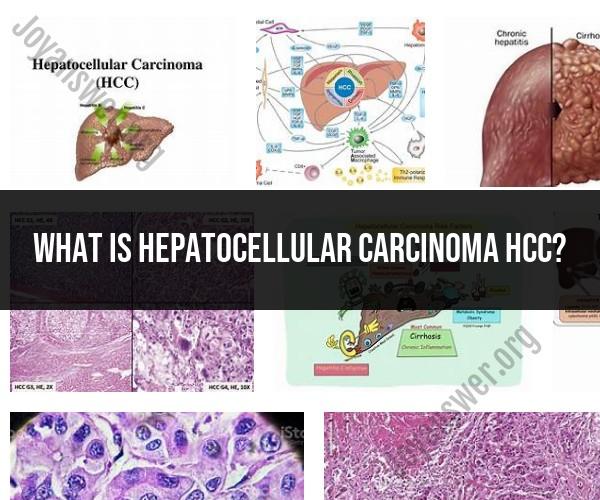 Hepatocellular Carcinoma (HCC): Understanding Liver Cancer's Medical Terminology