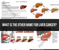 Hepatocellular Carcinoma (HCC): Unveiling Another Name for Liver Cancer