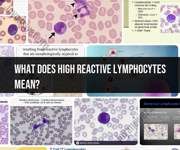 High Reactive Lymphocytes: Exploring the Significance