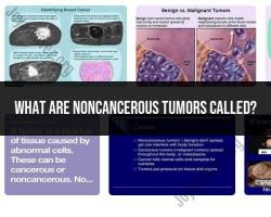 Identifying Noncancerous Tumors: Common Terminology