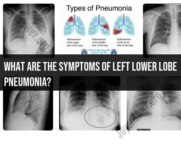 Identifying Symptoms of Left Lower Lobe Pneumonia