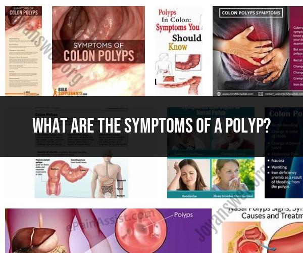 Identifying the Symptoms of Polyps