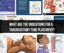 Indications for Tracheostomy Tube Placement: Medical Insights