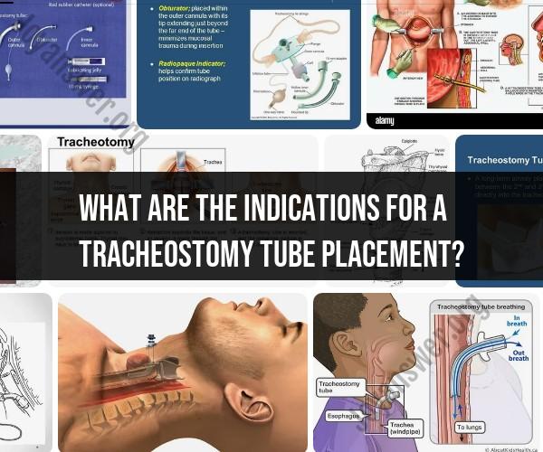 Indications for Tracheostomy Tube Placement: Medical Insights