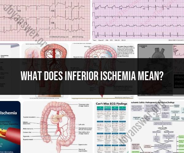 Inferior Ischemia: Understanding the Condition