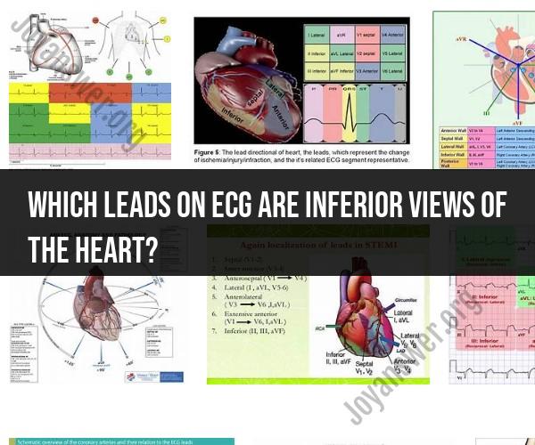 Inferior Leads on ECG: Views of the Heart Explained