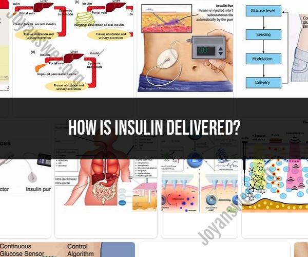 Insulin Delivery Methods: Exploring Options and Techniques
