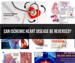 Ischemic Heart Disease: Reversal Possibilities and Management