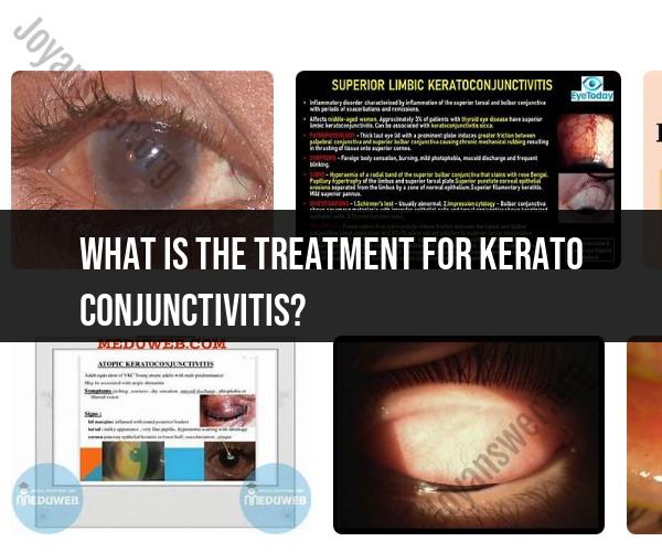 Keratoconjunctivitis Treatment: Approaches to Eye Infection Management