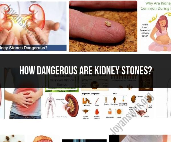 Kidney Stones: Understanding the Dangers and Risks