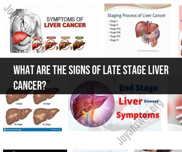 Late Stage Liver Cancer: Recognizing the Signs and Symptoms