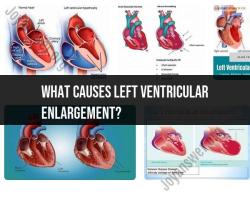 Left Ventricular Enlargement: Causes and Cardiac Implications