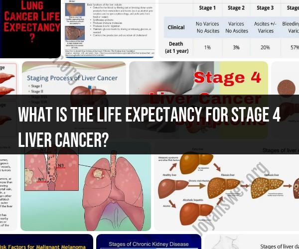 Life Expectancy for Stage 4 Liver Cancer: Factors and Outlook
