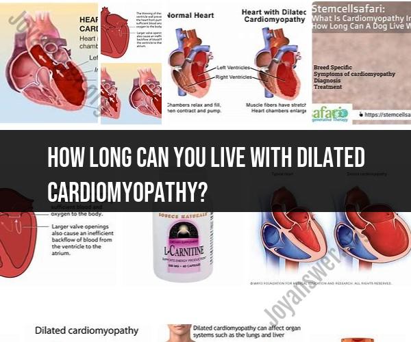 Life Expectancy with Dilated Cardiomyopathy: What to Expect