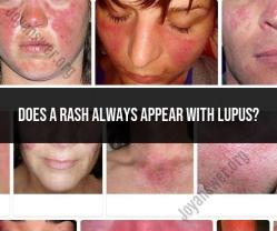 Lupus and Rash: Understanding the Link and Potential Triggers