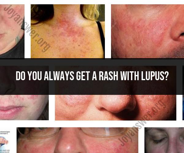 Lupus Rash: Understanding Symptoms and Variations
