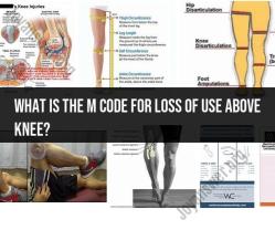 M Code for Loss of Use Above Knee: Medical Billing