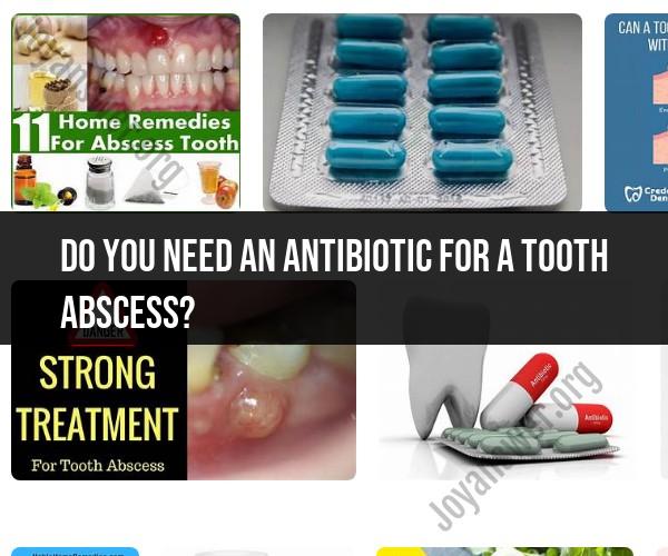 Managing Tooth Abscess: Do You Need an Antibiotic?