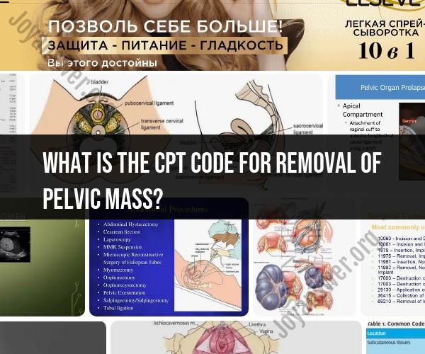 Medical Coding for Pelvic Mass Removal: CPT Code