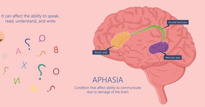 Navigating Expressive Aphasia: Treatment Options and Approaches