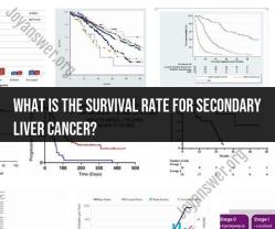 Navigating Survival Rates: Understanding Secondary Liver Cancer