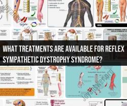 Navigating Treatment Options for Reflex Sympathetic Dystrophy Syndrome