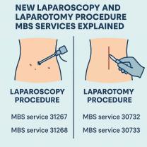 New Laparoscopy and Laparotomy Procedure MBS Services Explained