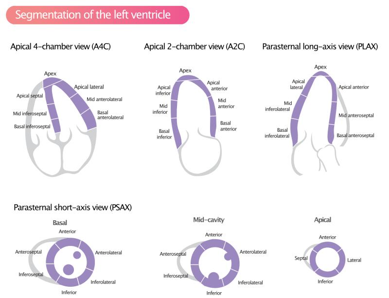 Normal Thickness of Left Ventricular Wall: Understanding Cardiac Measurements