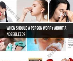 Nosebleeds: When Should You Be Concerned?