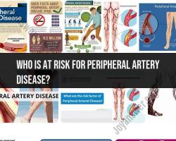 Peripheral Artery Disease (PAD) Risk Factors