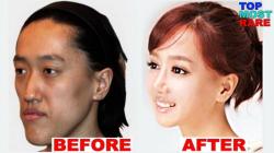 Positive Aspects of Plastic Surgery: Benefits and Considerations