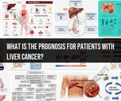 Prognosis for Patients with Liver Cancer